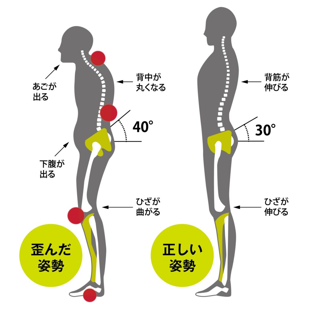 不思議インソール『LOFE・アーチサポート』期間限定販売会;